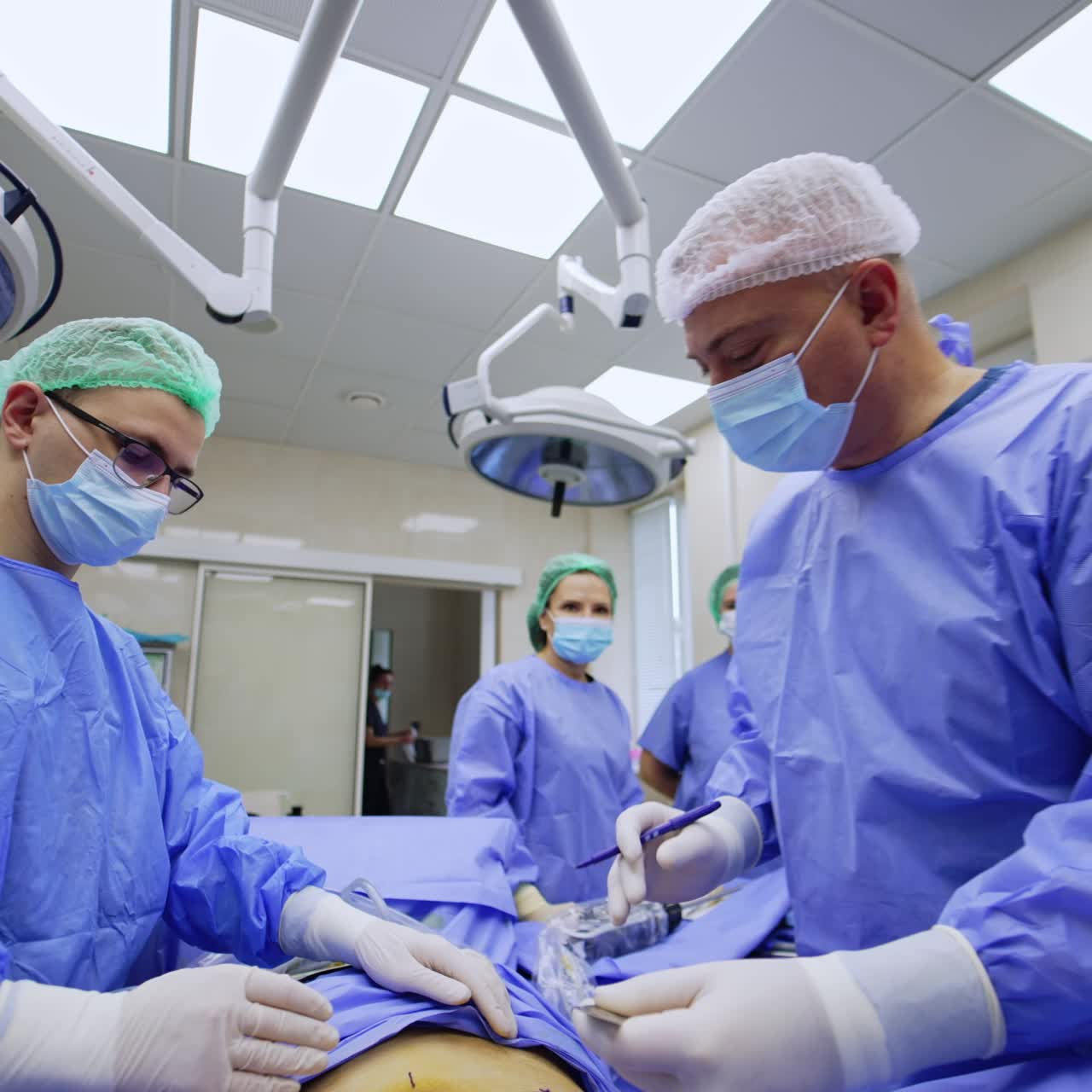 Marking the areas for the future laparoscopic intrusion. Doctor draws the lines with a blue pen and a ruler. Low angle view