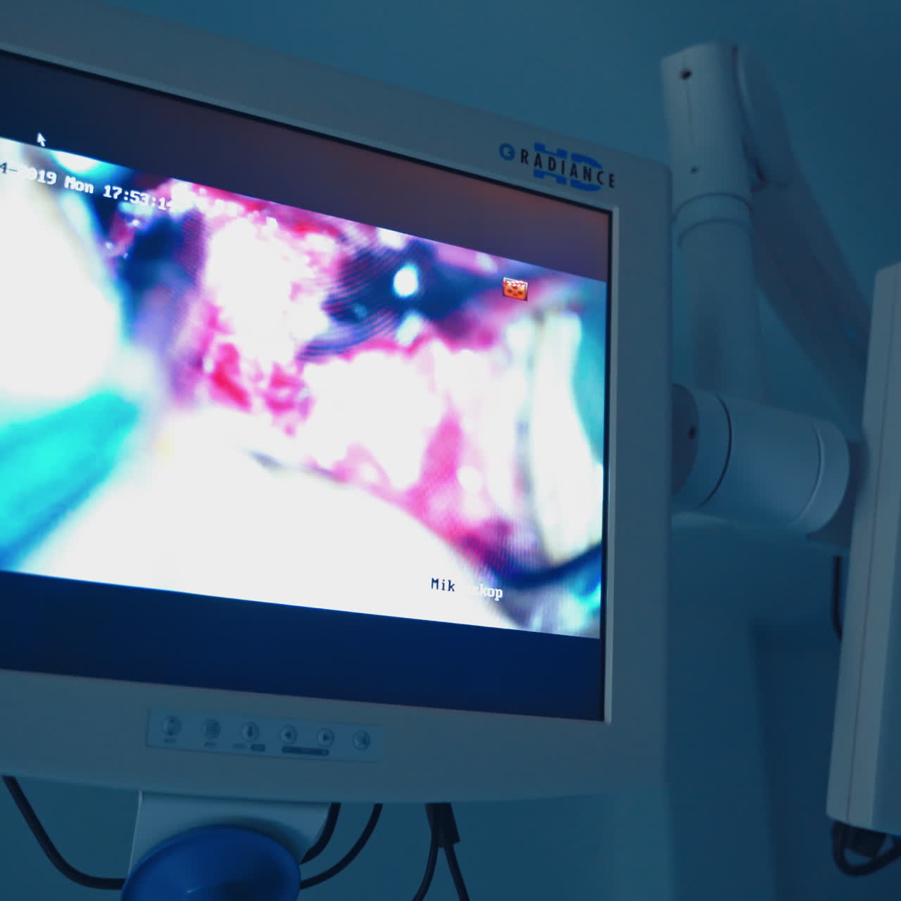 Modern equipment in the surgery room. Operation on the monitor. Process of endoscopic operation is depicted on the screen in clinic.