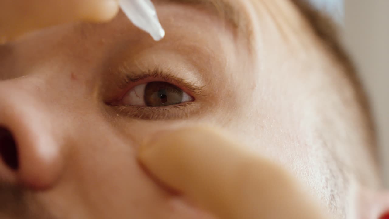 Primer plano extremo de un hombre aplicándose gotas oftálmicas en el ojo. Concepto de cuidado ocular, ojos secos, tratamiento médico, higiene y rutina de salud.