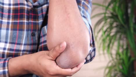 close-up view of a person's elbow with rough, dry, and discolored skin