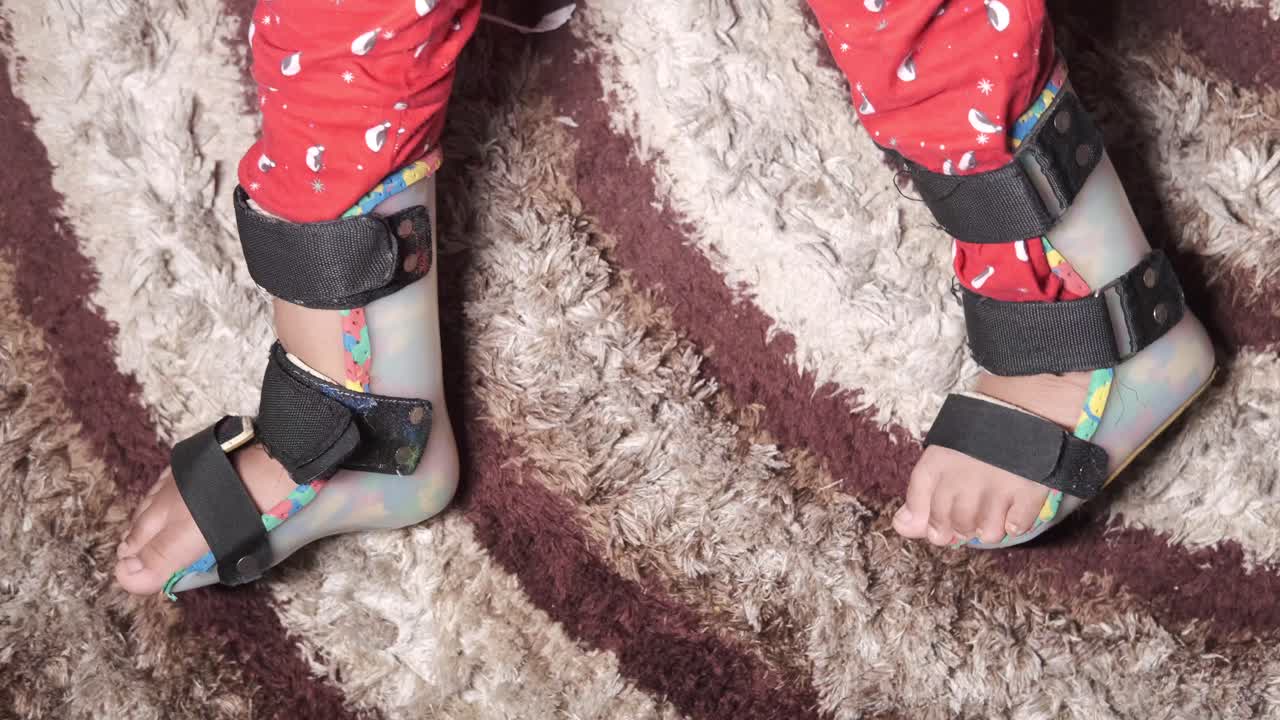 niño con aparatos ortopédicos para el tobillo