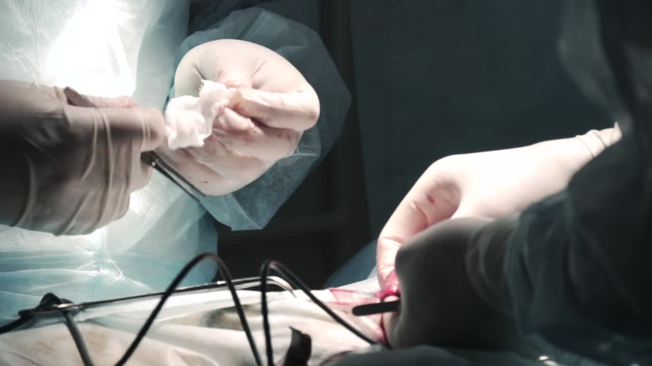 procedimiento quirúrgico