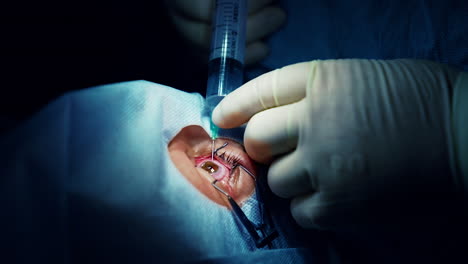 laser vision correction. patient in the operating room during ophthalmic surgery
