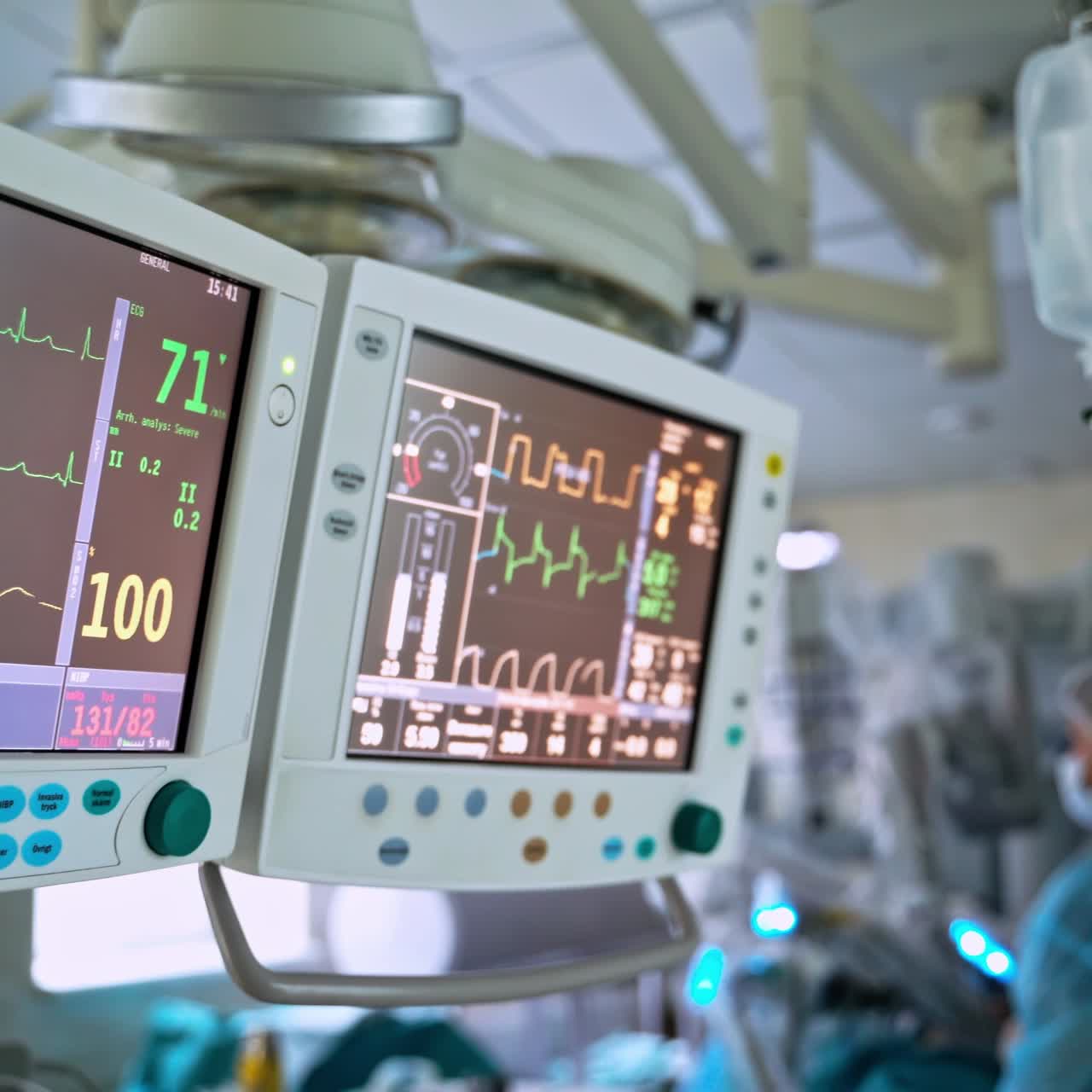 Monitors in intensive care unit. Heart beat of a patient on the screen of computers during operation in the hospital. Healthcare concept.