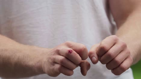manos heridas y sucias de un hombre caucásico
