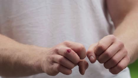 wounded and dirty hands of a caucasian man