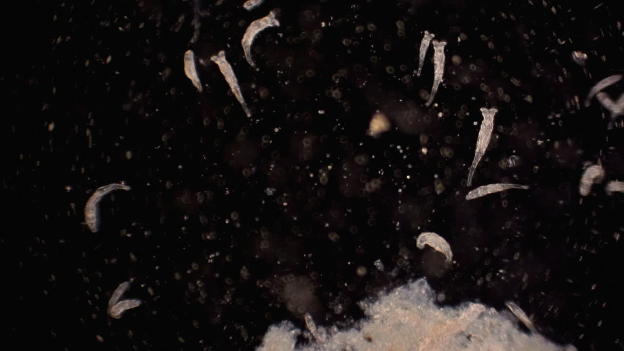 미세한 로티퍼가 이동하고 먹이를 걸러냅니다.