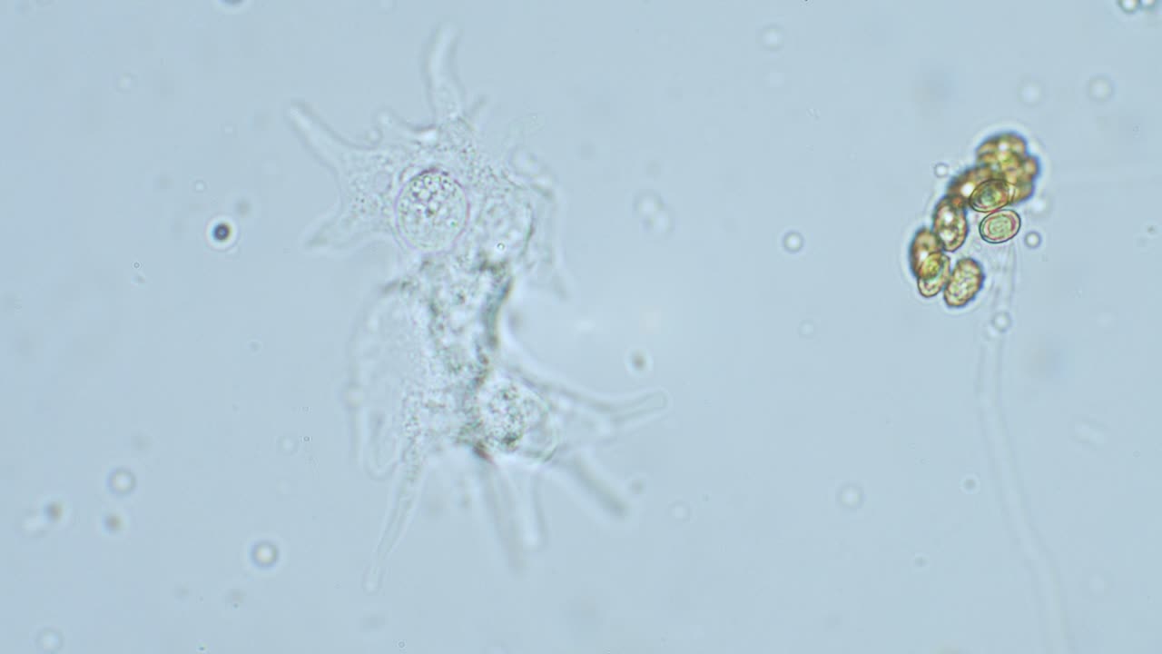 Slime mold amoeba in high magnification in motion