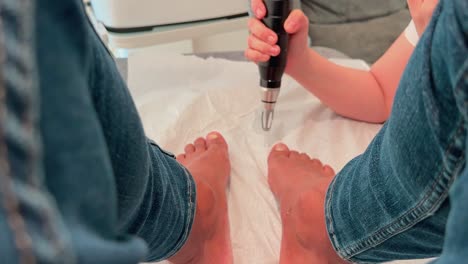 close-up of toenail laser treatment for fungal infection in clinical setting - effective non-invasive therapy for nail health