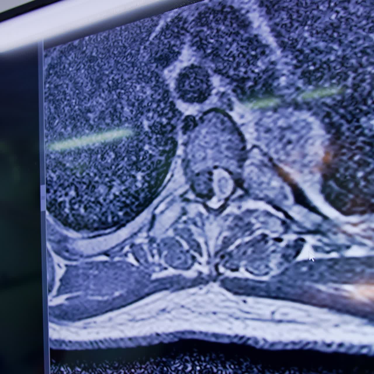 Organi e sistemi umani su una scansione MRI. Primo piano. Medico non identificato che analizza la scansione prima della neurochirurgia