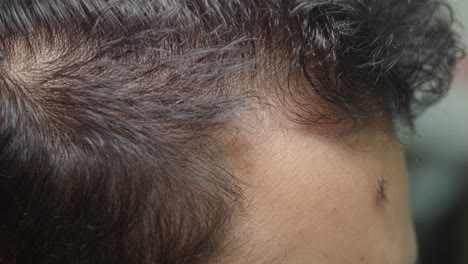 hair loss on head