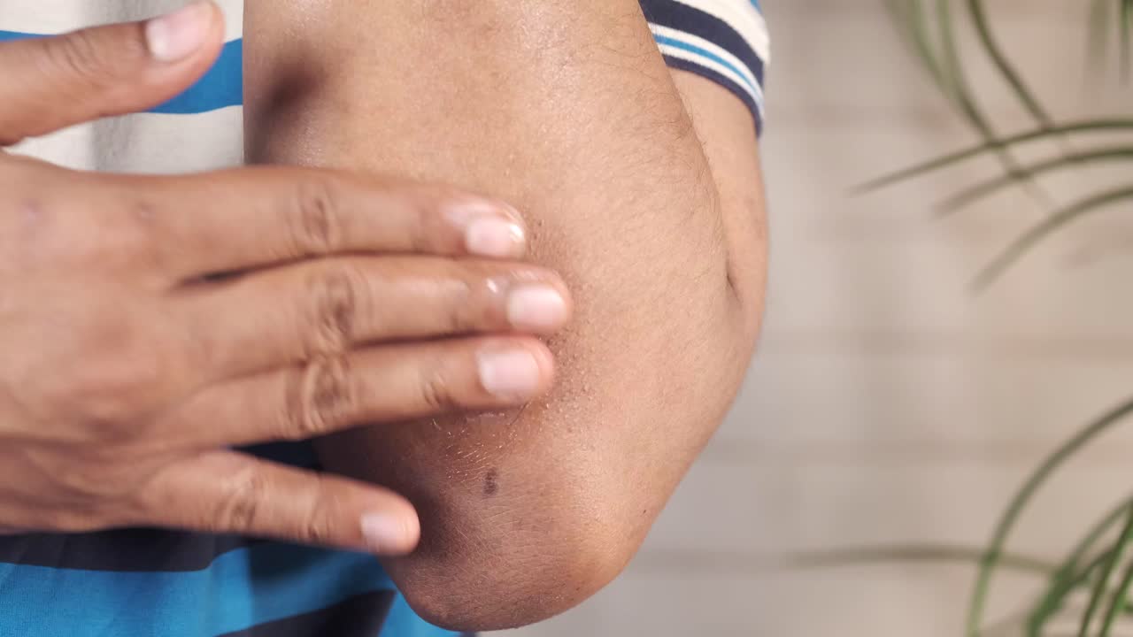 aplicación de crema en el codo