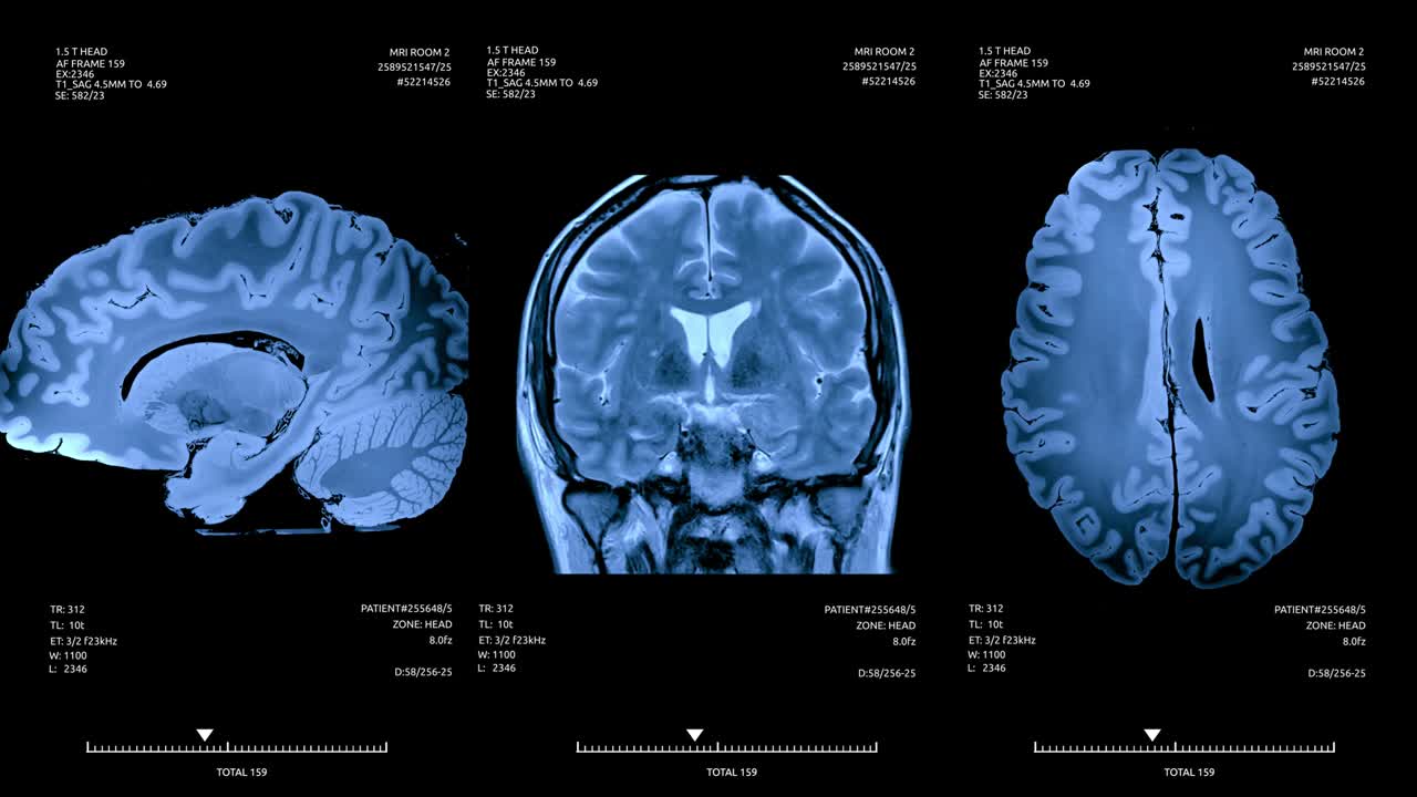 animación de la pantalla del escáner cardíaco. datos médicos de diagnóstico.