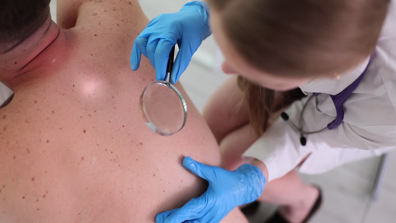 Dermatologist Examining Moles on Patient's Back