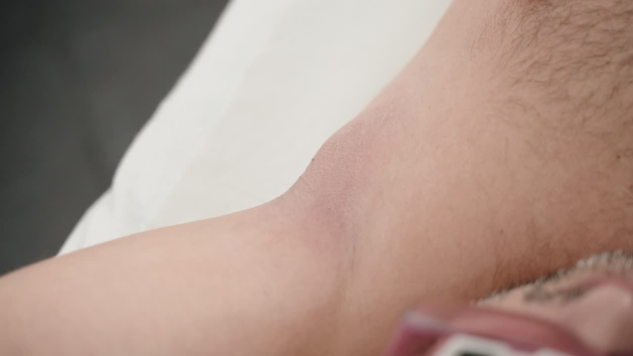técnico aplicando gel en la axila de un hombre con guantes en preparación para la depilación láser