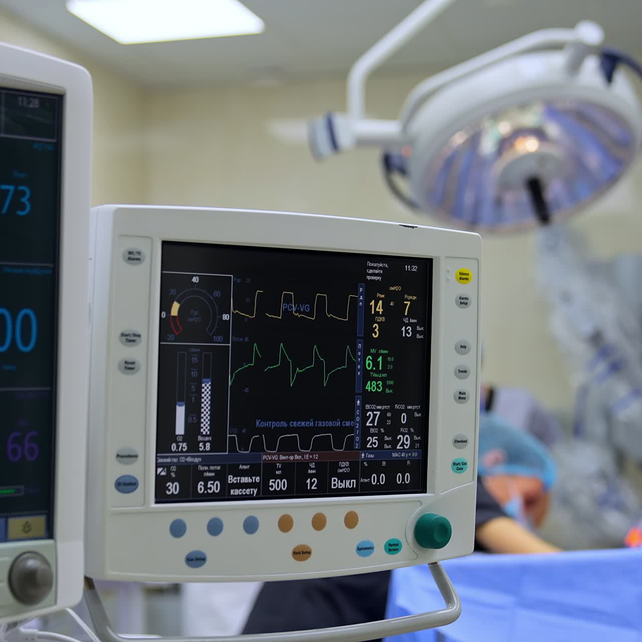 Due schermi che mostrano i parametri vitali di un paziente. Monitor del sistema di ventilazione polmonare artificiale in funzione durante un intervento chirurgico. Medici che lavorano sullo sfondo