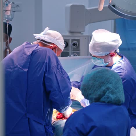doctors in blue uniform doing a surgery in clinic. group of neurosurgeons performing an operation in medical center.