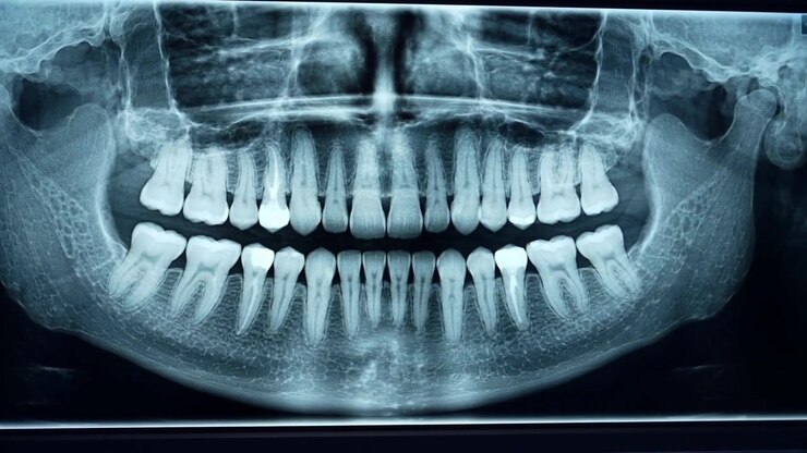 Panoramic Dental X-ray Scan on Digital Monitor