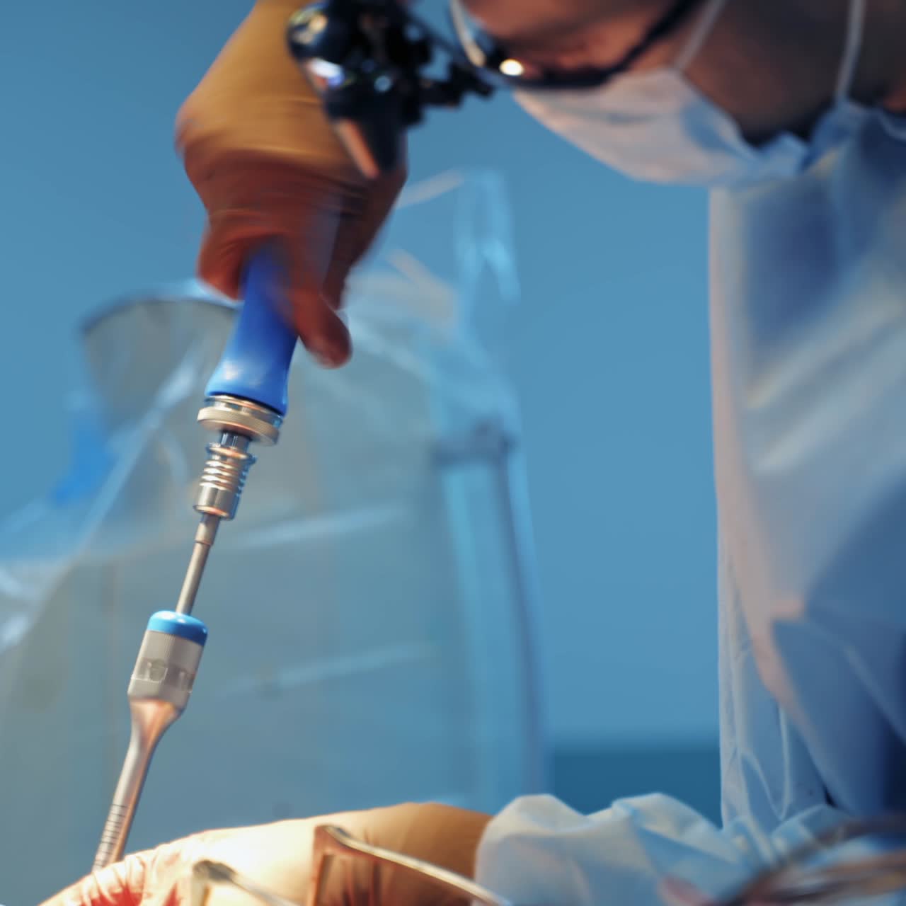 Doctor in surgery spectacles provide operation with special neurosurgery equipment. Unrecognizible neurosurgeon in scrubs