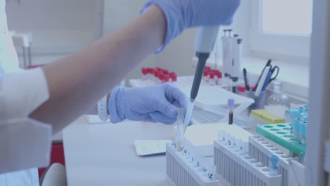 Laboratory worker performing a blood test