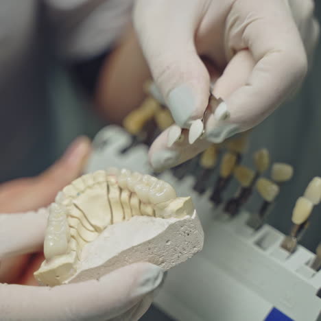 female hands in white gloves choosing the right color of a tooth to a dental model of jaw. teeth model in the hands of a professional dentist. close-up