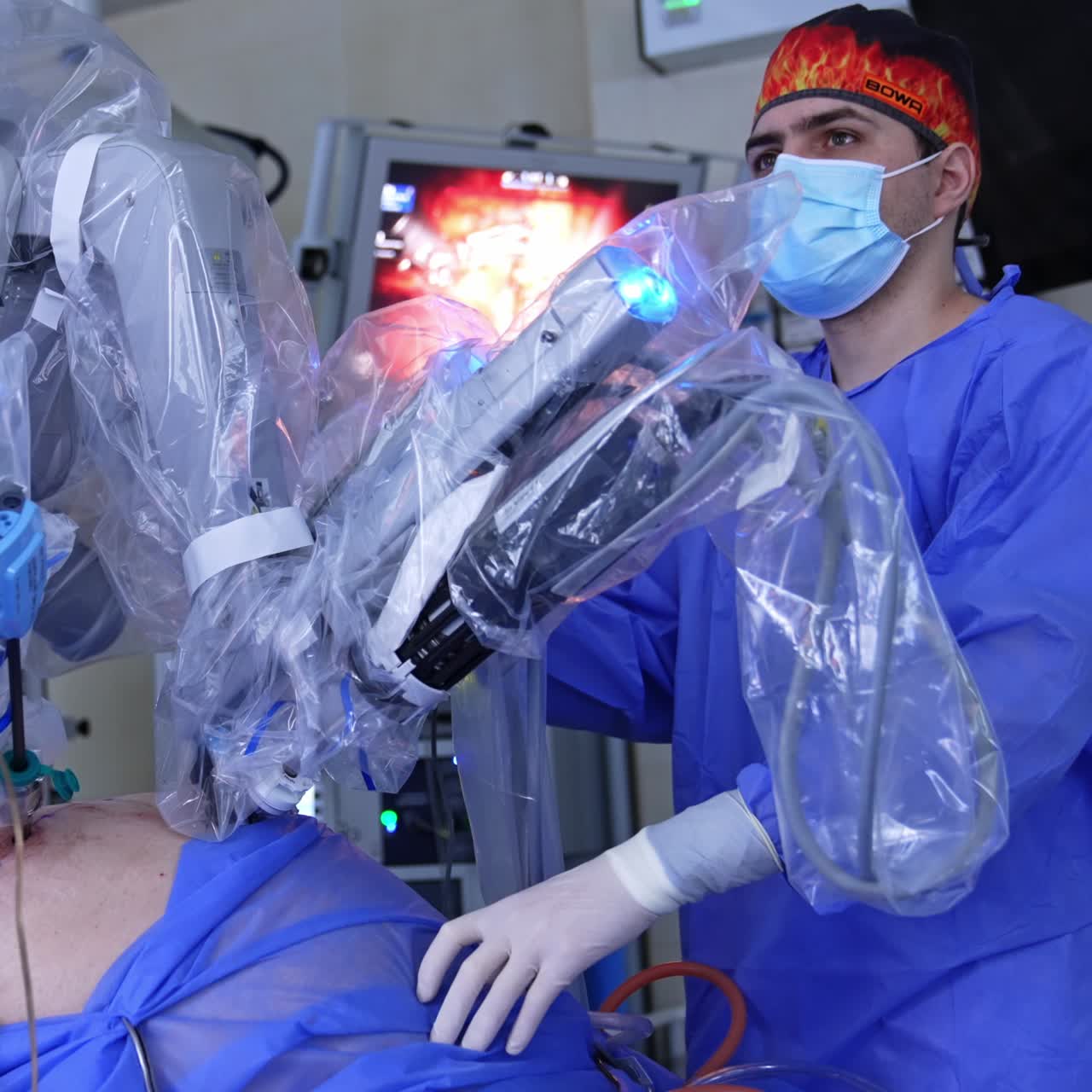Da Vinci robotic system performs laparoscopy. Surgeon stands near equipment and watches operation on the screen
