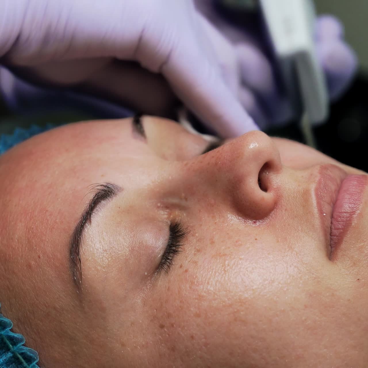 Woman having a procedure of face cleansing. Cosmetologist uses special ultrasonic scrubber for skincare. Extreme close up