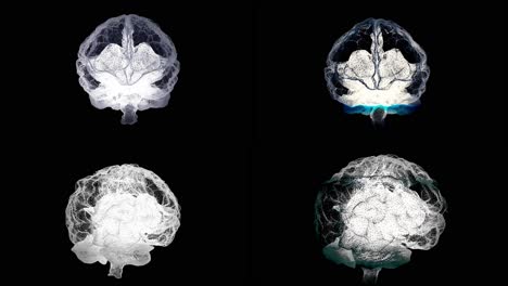 3d model of the human brain