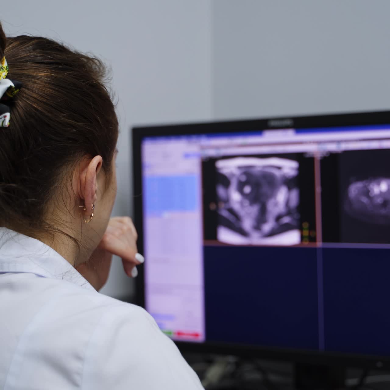 Un tecnico di laboratorio esamina attentamente l'immagine di una risonanza magnetica. Vista posteriore di una dottoressa seduta su una sedia davanti al computer.