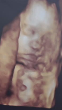 human embryo in color on the screen during sonography. ultrasound of pregnant woman. scientific analysis. tiny baby in mother's belly. close-up. vertical video