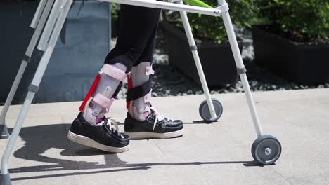 person with a broken leg using a walker