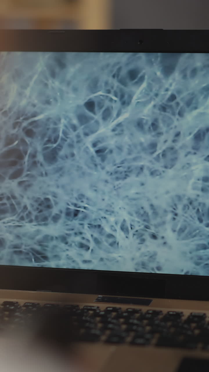 Examining white fiber structure of testing biomaterial sample with microscope on laptop screen picture at experiment in scientific laboratory closeup