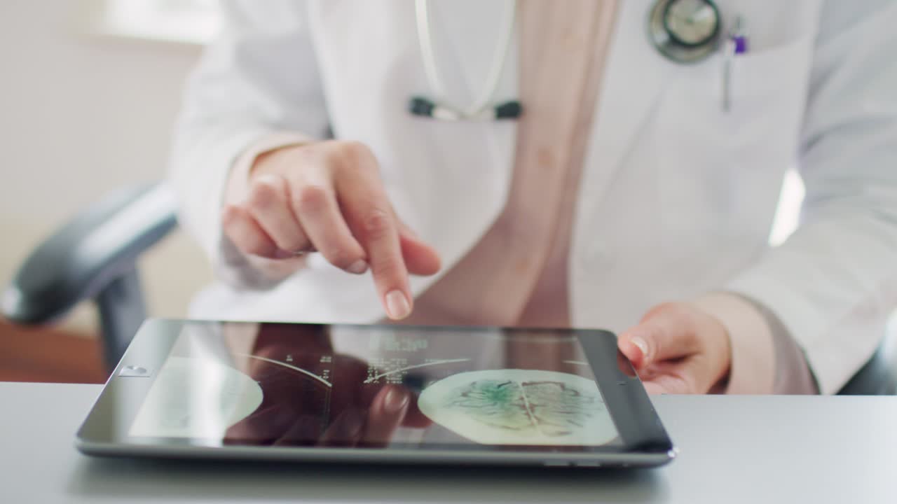 doctora analizando el escáner de rayos x del cerebro en una tableta digital 4k