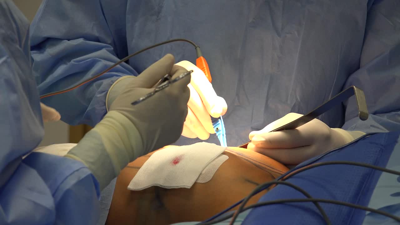 유방 확대술은 여성의 가슴 크기를 늘리고 질감을 변경하는 데 사용되는 유방 이식 및 지방 이식 유방 성형술에 대한 성형 수술 용어입니다.