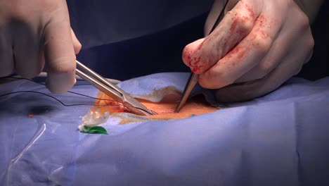 Chirurgisches-Nahtmaterial-Ist-Ein-Medizinisches-Gerät,-Das-Verwendet-Wird,-Um-Körpergewebe-Nach-Einer-Verletzung-Oder-Operation-Zusammenzuhalten