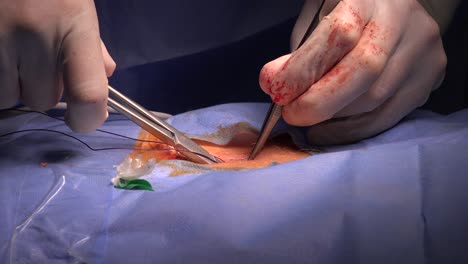 surgical suture is a medical device used to hold body tissues together after an injury or surgery