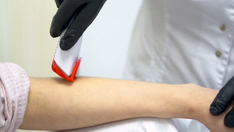 epilating a woman's arm