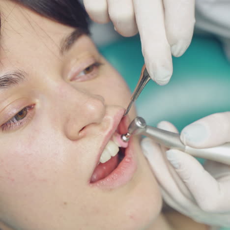 stomatologist in white gloves cleaning the teeth of a woman in dental cabinet. female's teeth and special dental tool-brush in work. close-up