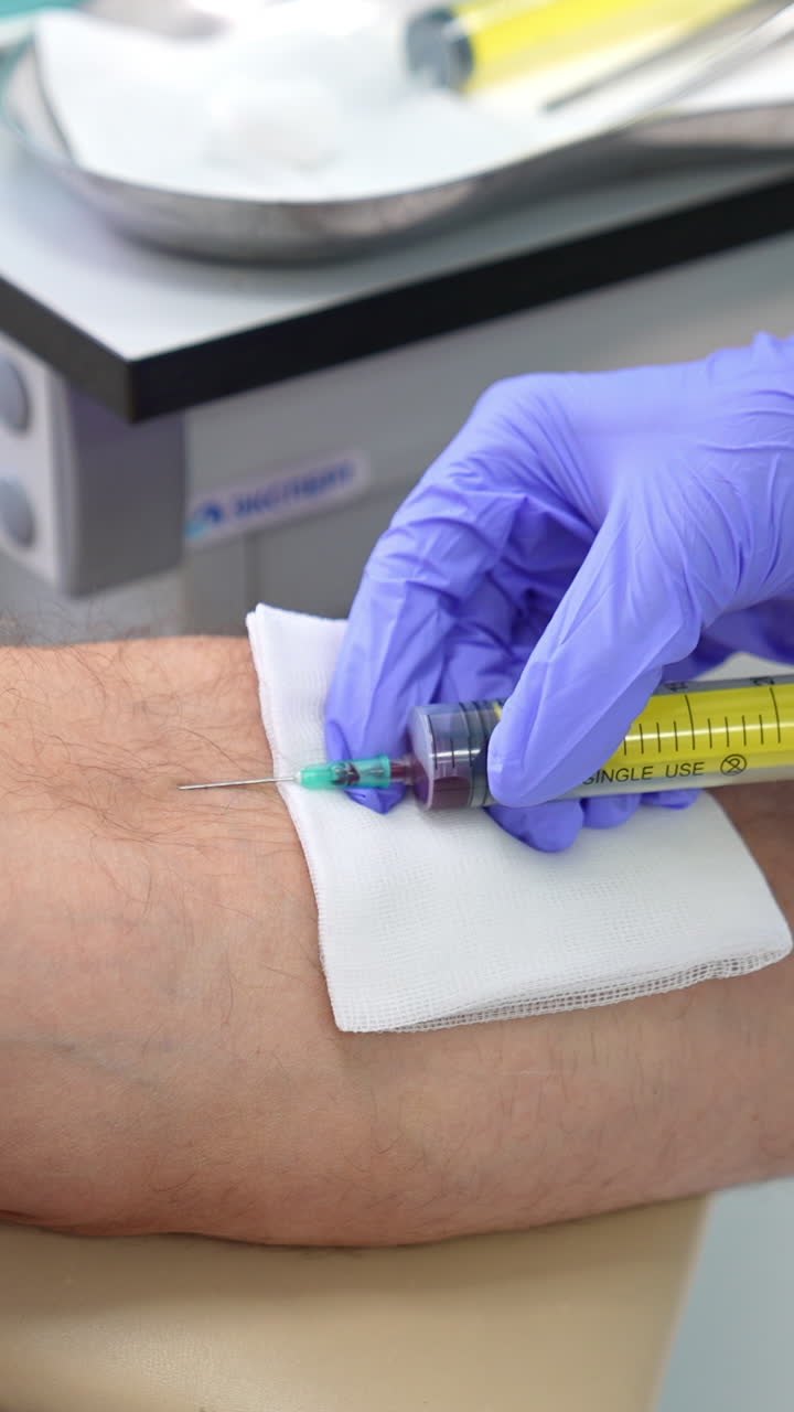 Nurse's hands in gloves input syringe into vein of a patient. Medic takes blood sample of a man. Close up. Vertical video