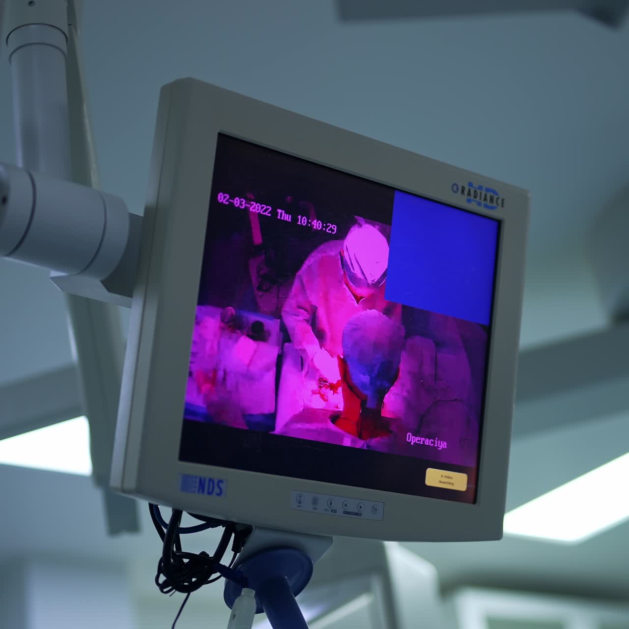Little screen showing the surgery conducted in the ward from top view. Modern equipment in the surgical room