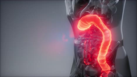 examen de radiología del colon humano