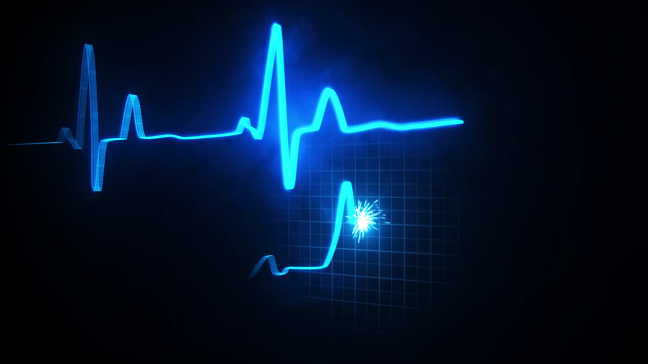 심장 박동 감시 (ecg)