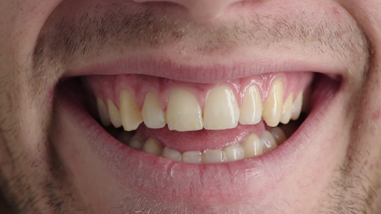 cerca los labios del joven sonriendo los dientes mostrando las encías expresión feliz pelo facial rastro conceptos de salud dental