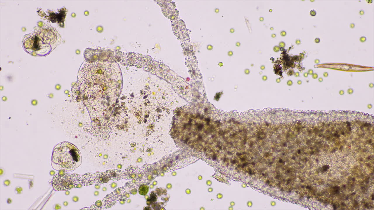 Microscopic Life in Pond Water: Protozoa and Algae