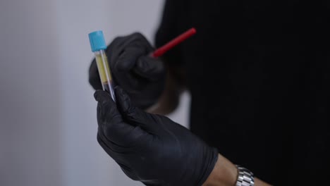 medical professional handling blood sample with syringe