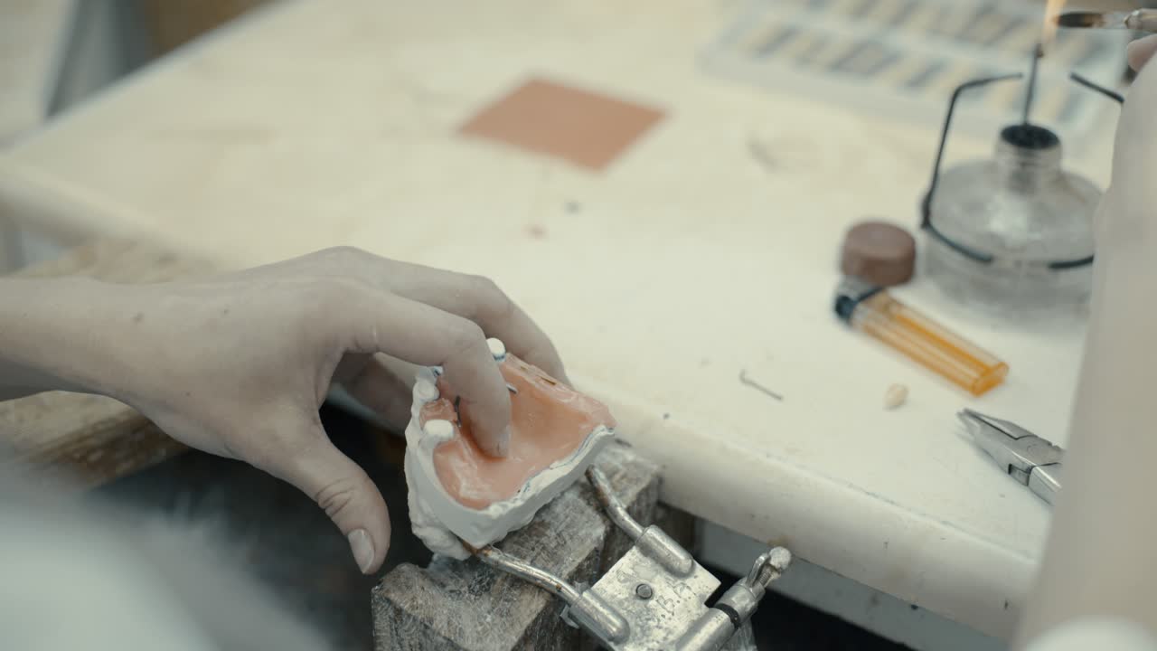 el proceso de creación de una corona y un yeso