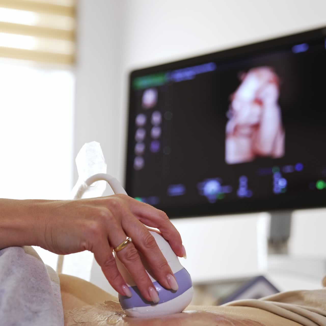 Ultrasonic check for the pregnant patient. Doctor is performing ultrasound diagnostics to a woman with big belly. Screen at backdrop in blur