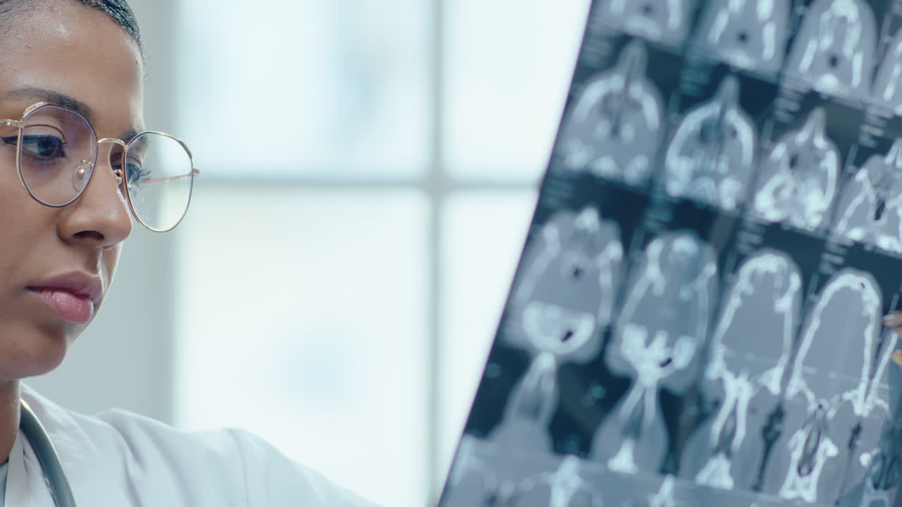 doctora examinando una tomografía computarizada del cerebro en una clínica
