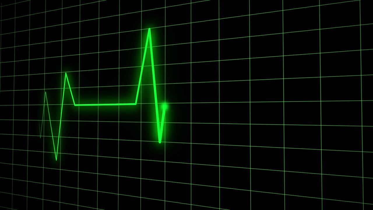 Linea verde del battito cardiaco su monitor EKG su sfondo a griglia