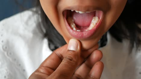 child with missing teeth